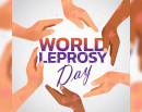 आज ७३ औँ विश्व कुष्ठरोग दिवस मनाइँदै_img