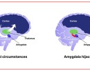 के हो एमिग्डाला हाइज्याक ?_img