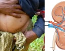 भारतमा मिर्गौला बेच्दै बङ्गलादेशी !_img