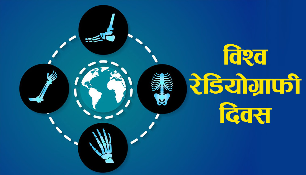 आज विश्व रेडियोग्राफी दिवस मनाइँदै